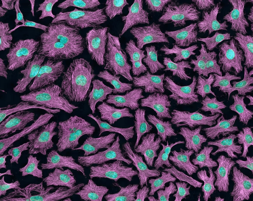 What are HeLa cells? A cancer biologist explains